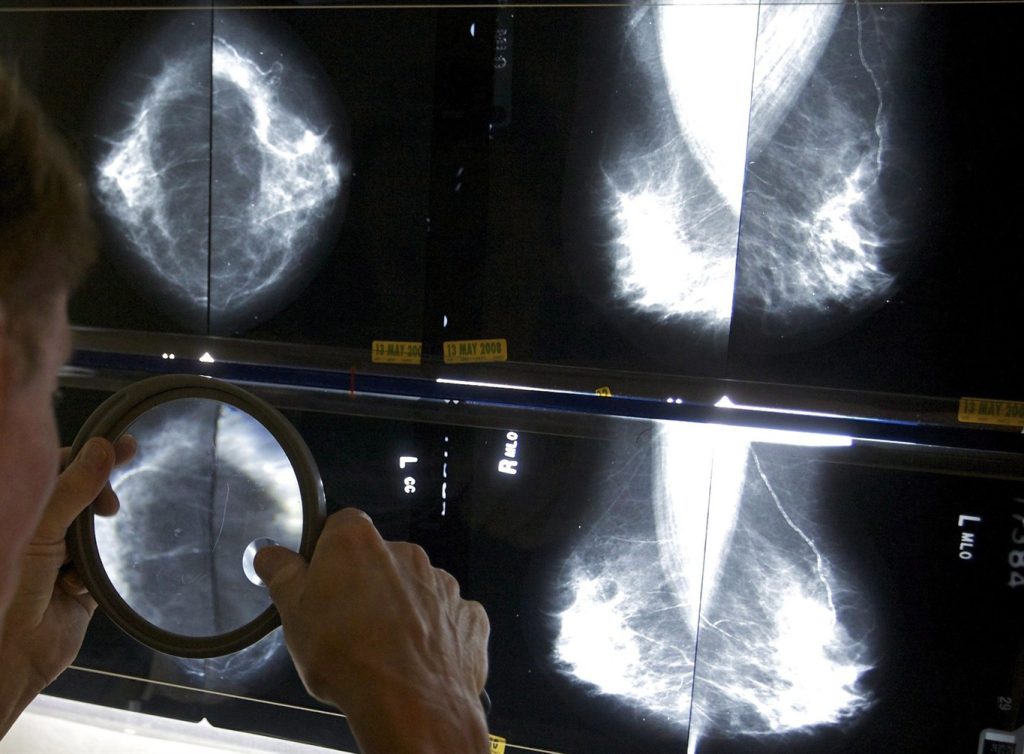 Ontario lowers mammogram self-referral age to 40 from 50, bookings can now be made