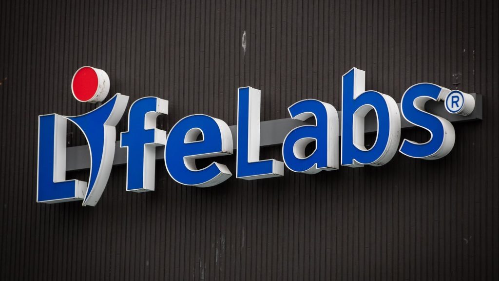 Possible strike at LifeLabs could affect Kitchener locations